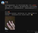 一網(wǎng)友被電吸門(mén)夾手 李想在微博在線支招